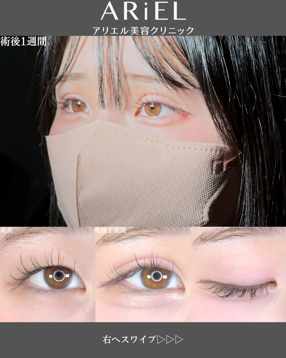 No.8686の症例写真